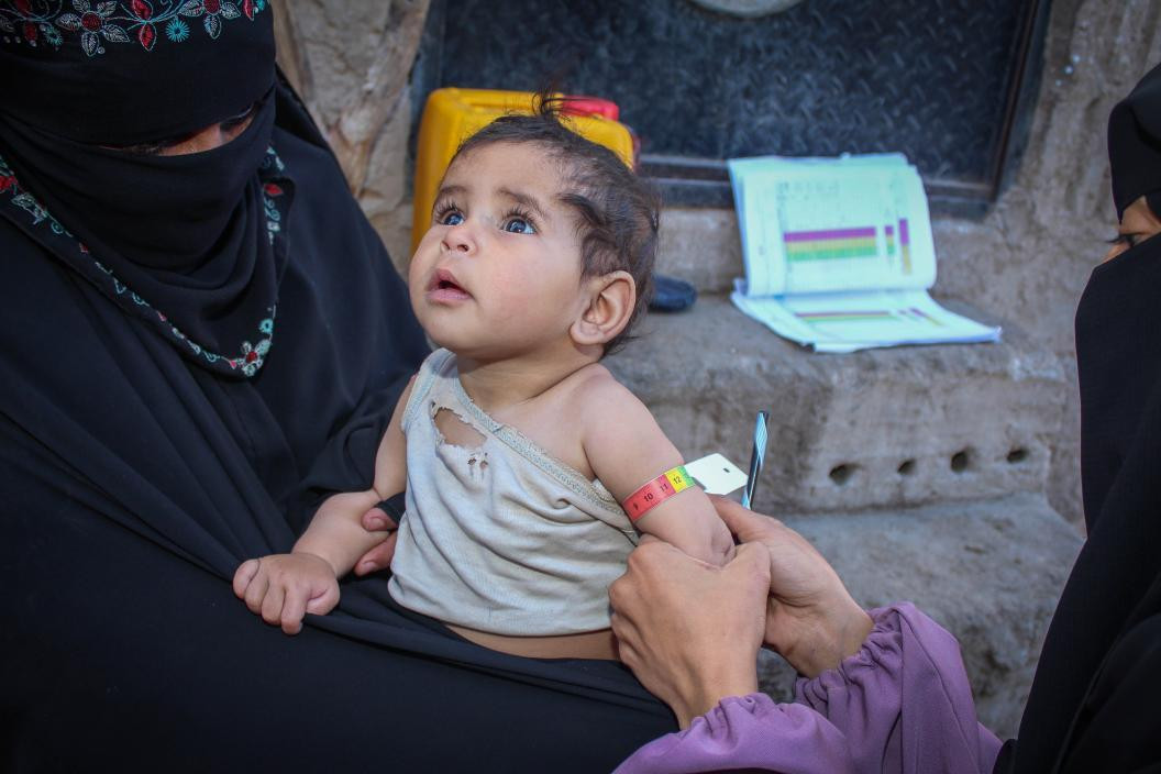 يونيسيف: اليمن لا تزال ضمن أسوأ البلدان للأطفال في العالم